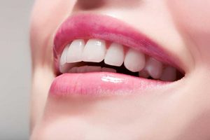  کامپوزیت ونیر چیست ؟