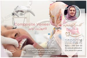 برای معاینه و مشاوره کامپوزیت ونیر با ما در تماس باشید.