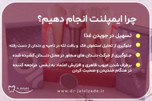مزایای ایمپلنت دندان