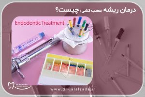 همه چیز درباره ی درمان ریشه