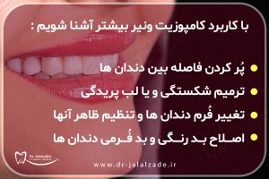 کاربرد کامپوزیت ونیر