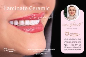 برای معاینه و مشاوره لمینیت سرامیکی باما در تماس باشید.