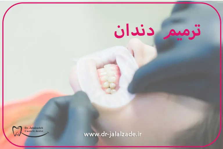 ترمیم دندان مشهد