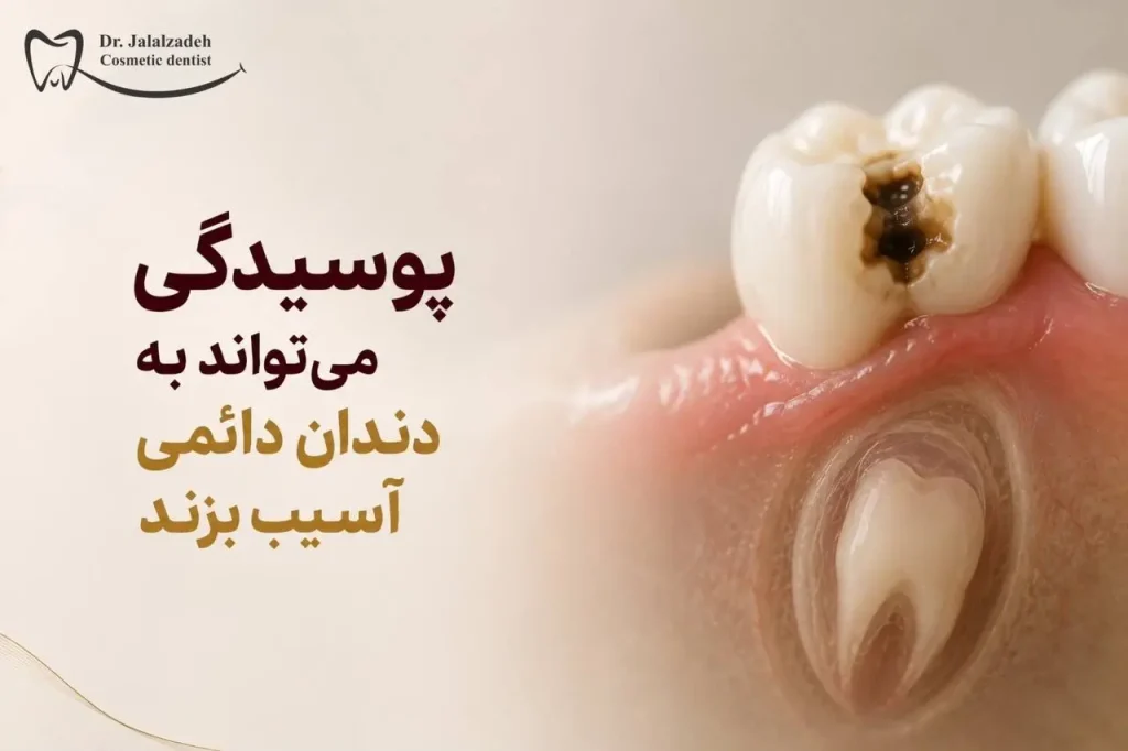 دندان شیری؛ نگهبان دندان دائمی