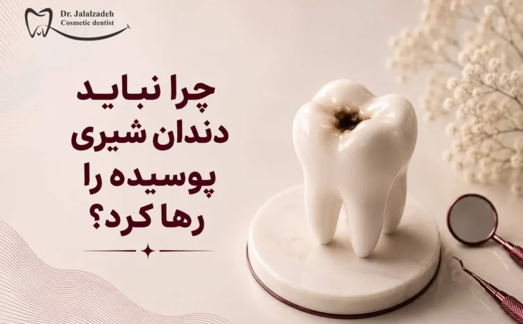  چرا نباید دندان شیری پوسیده را به حال خودش رها کرد؟